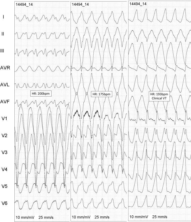 Figure 3