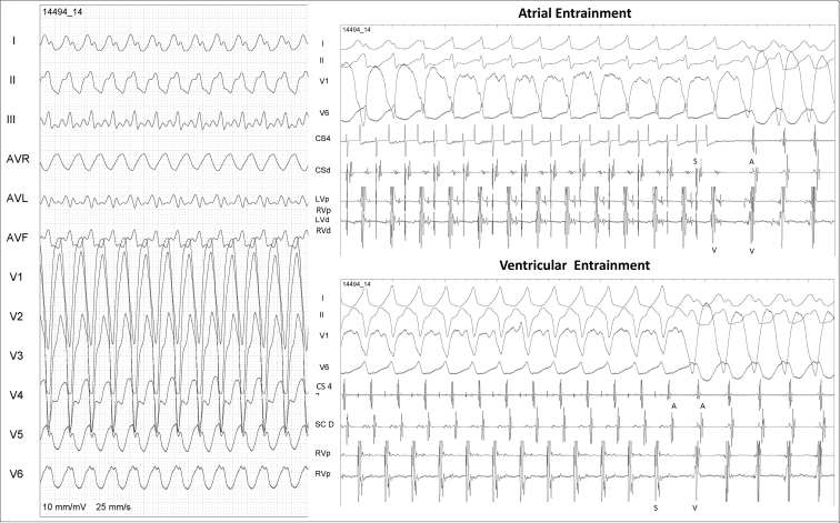 Figure 1