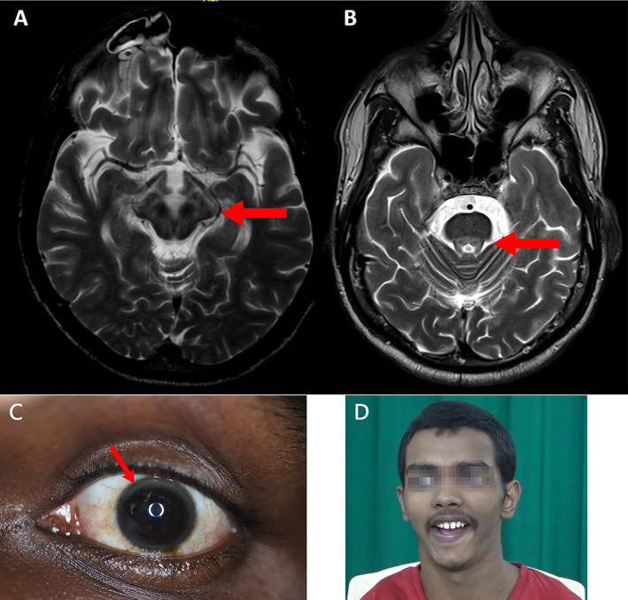 FIG. 1