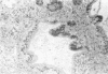 113