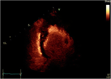Fig. 4