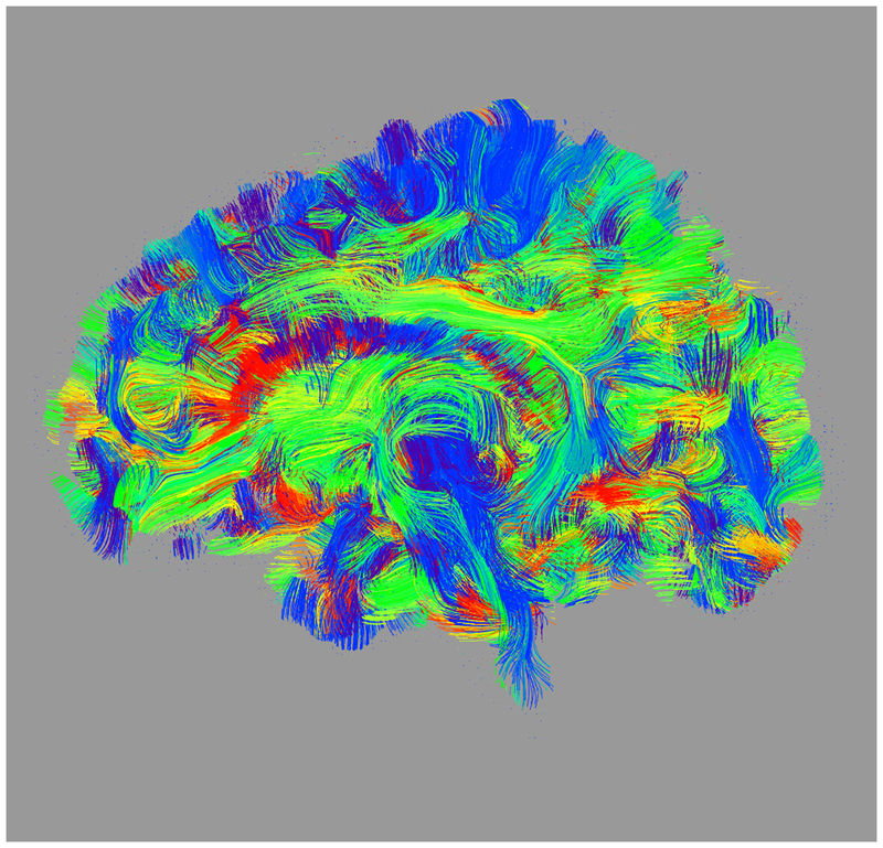 Figure 1: