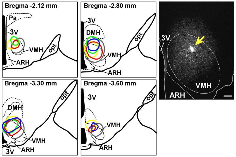 Fig. 1