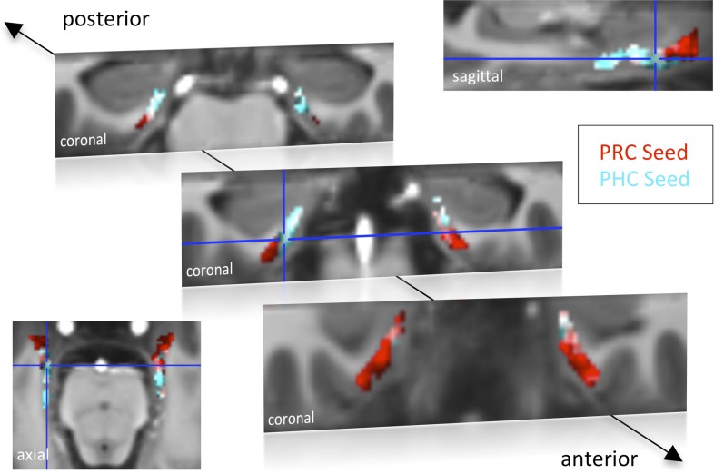 Figure 1—figure supplement 1.