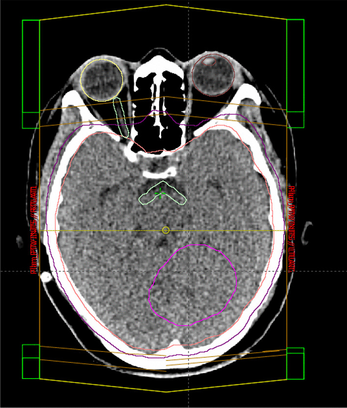 Fig. 5