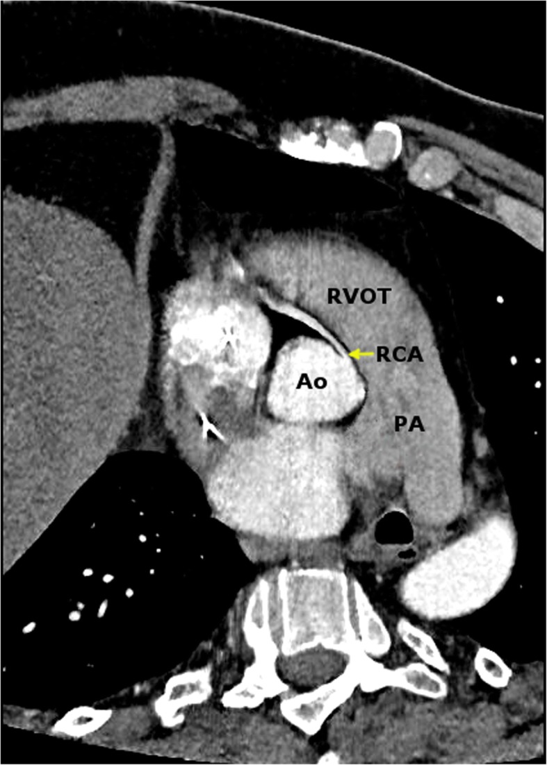 Fig. 5