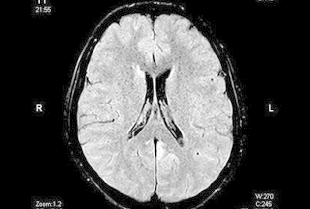 Fig. 2