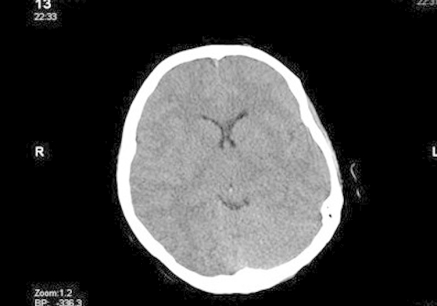 Fig. 1