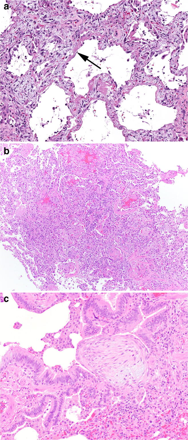 Fig. 3