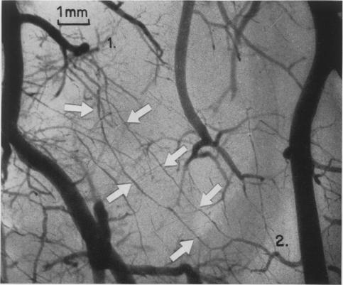 Fig. 17.