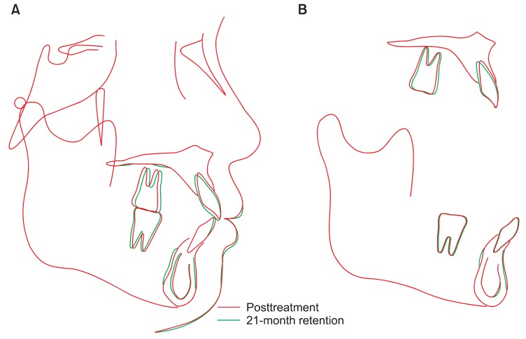 Figure 15