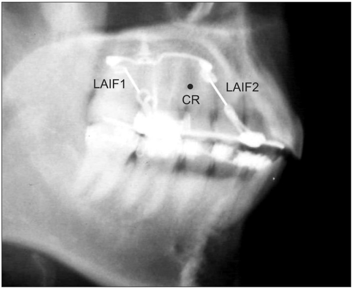 Figure 16