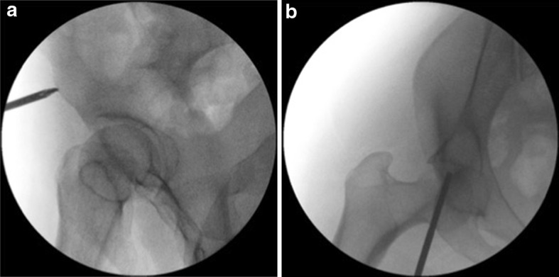 Fig. 5