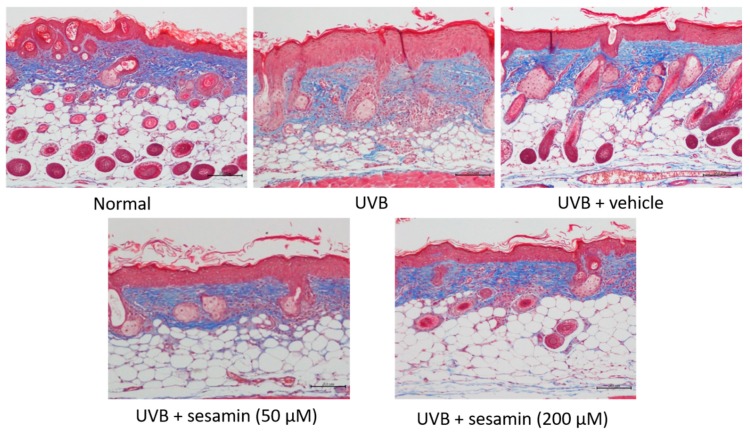 Figure 17