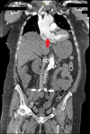 Fig 1: