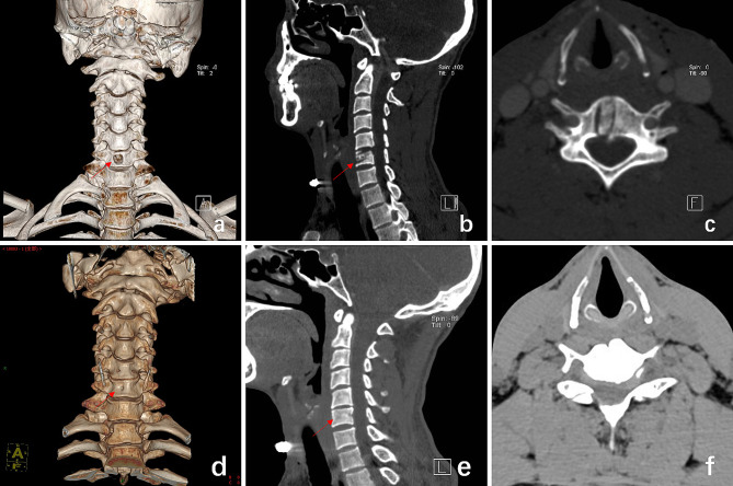 Fig. 6