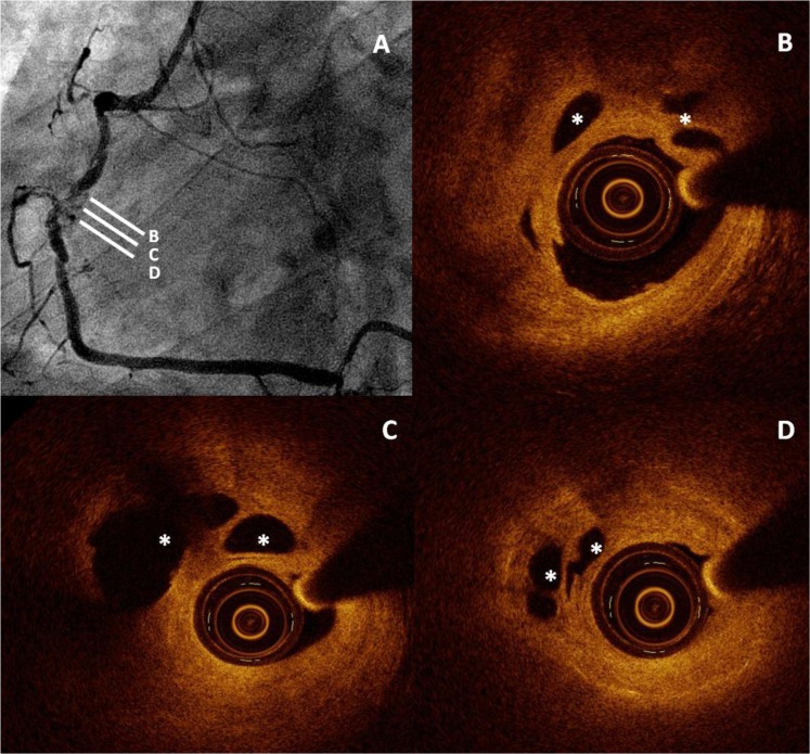 Fig. (3)