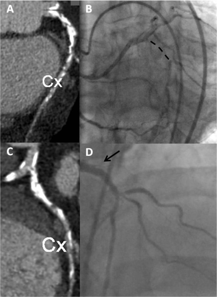 Fig. (1)