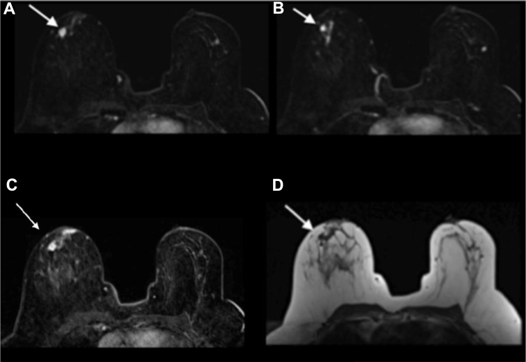 Fig. 11