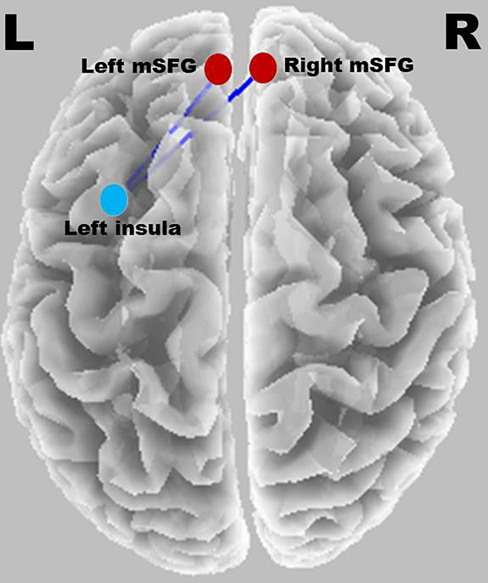 Fig. 11.