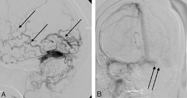 Fig 3.