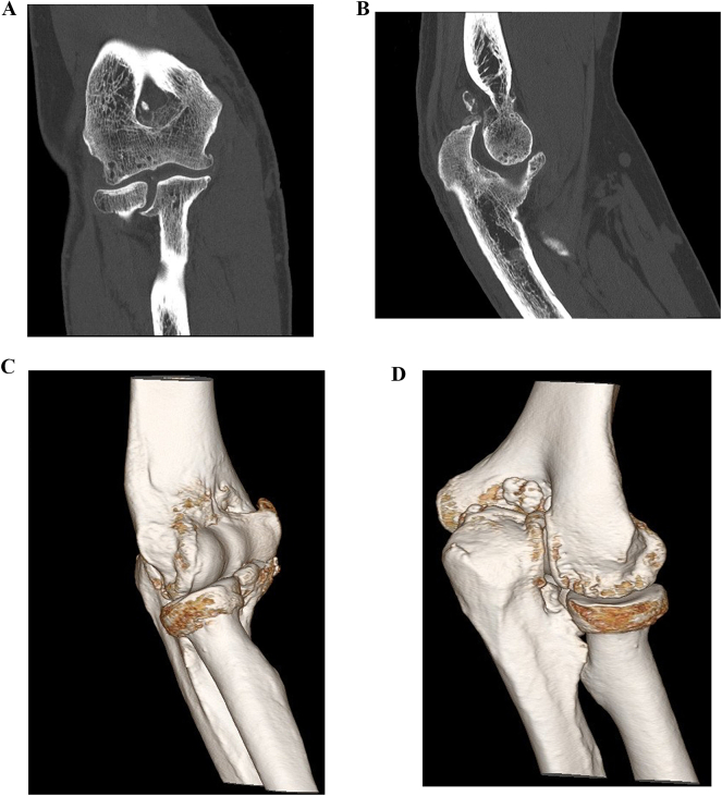 Fig. 2