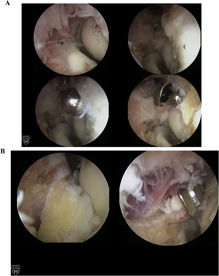 Fig. 3