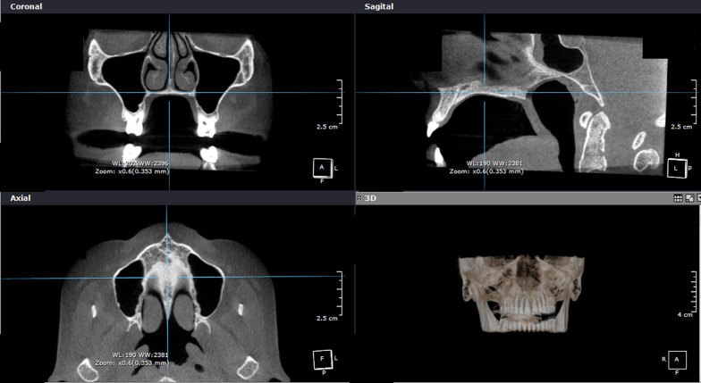 Fig. 2