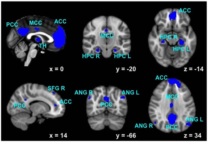 Fig. (1).