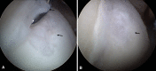 Fig. 2A–B