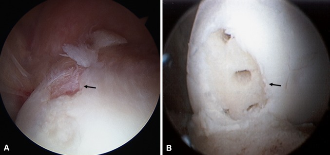 Fig. 3A–B