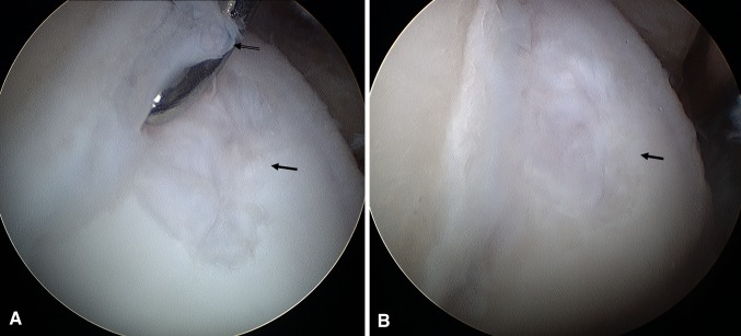 Fig. 2A–B