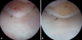 Fig. 4A–B