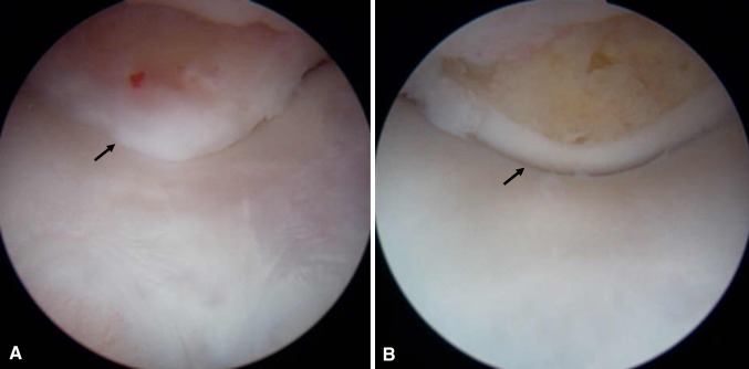 Fig. 4A–B