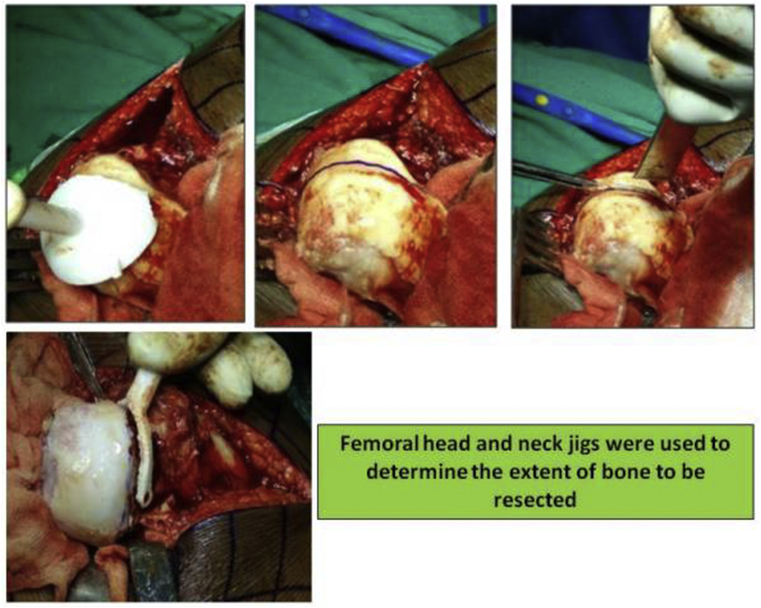 Fig. 6