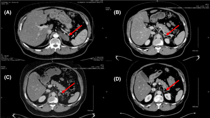 FIGURE 1