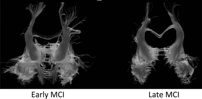 Fig. 30.