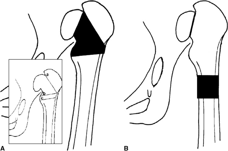 Fig. 3A–B