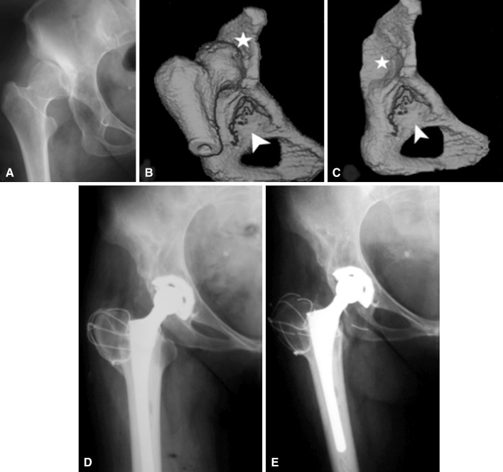 Fig. 1A–E