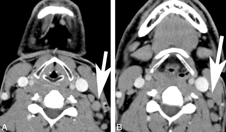 Fig 1.