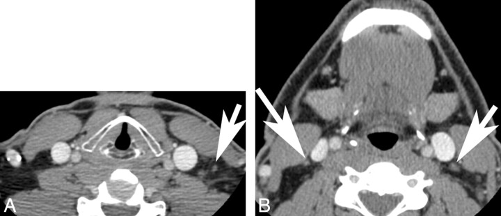 Fig 2.