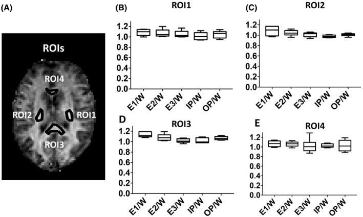 FIGURE 3