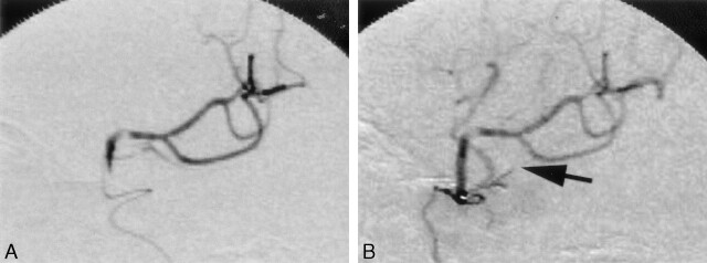 Fig 4.