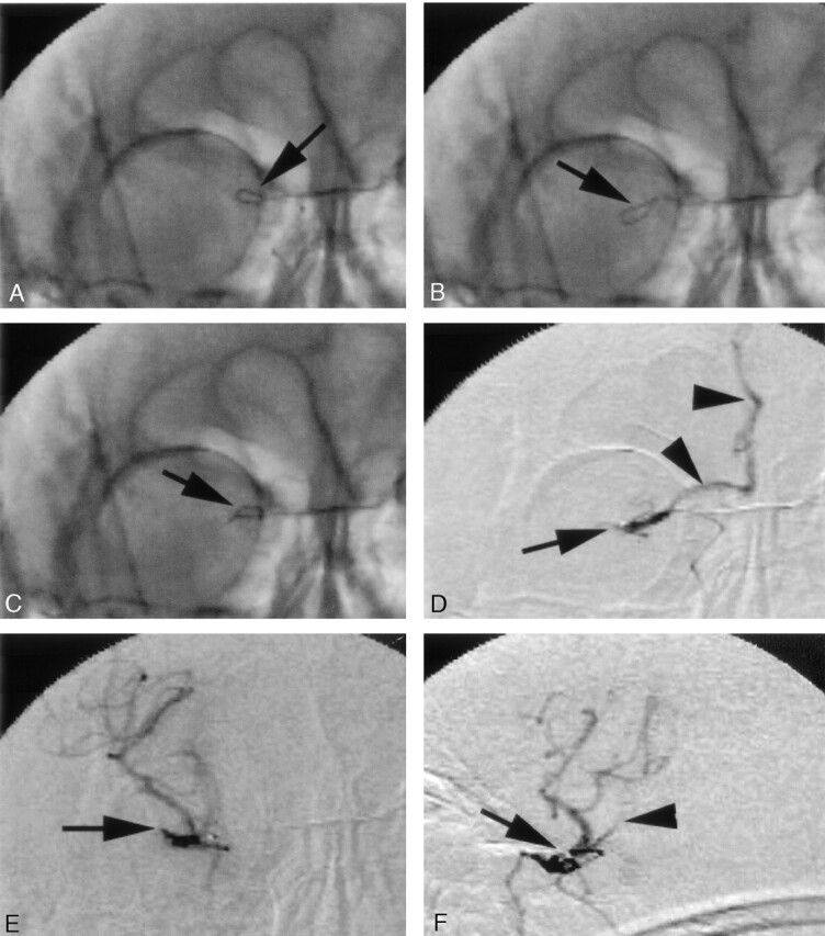 Fig 3.