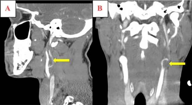 Fig. 3