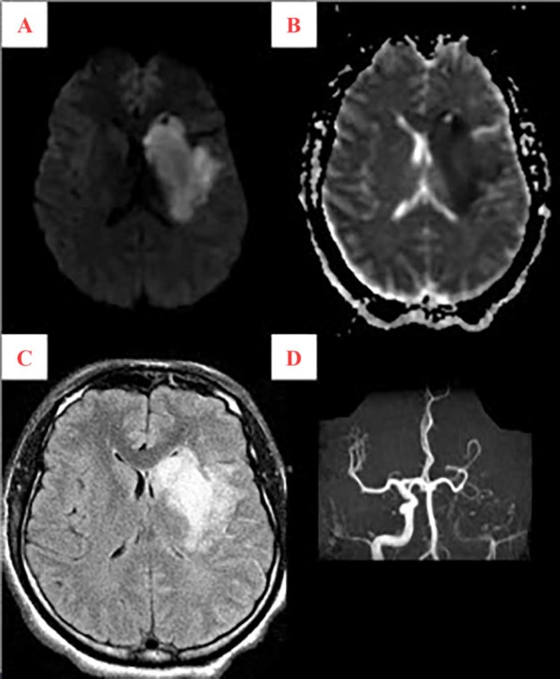 Fig. 4