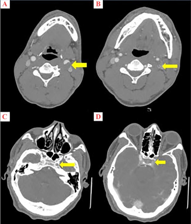 Fig. 2