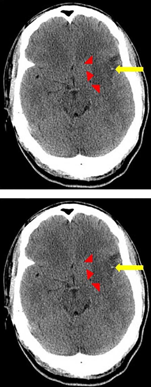 Fig. 1