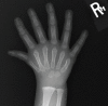 Figure 2a