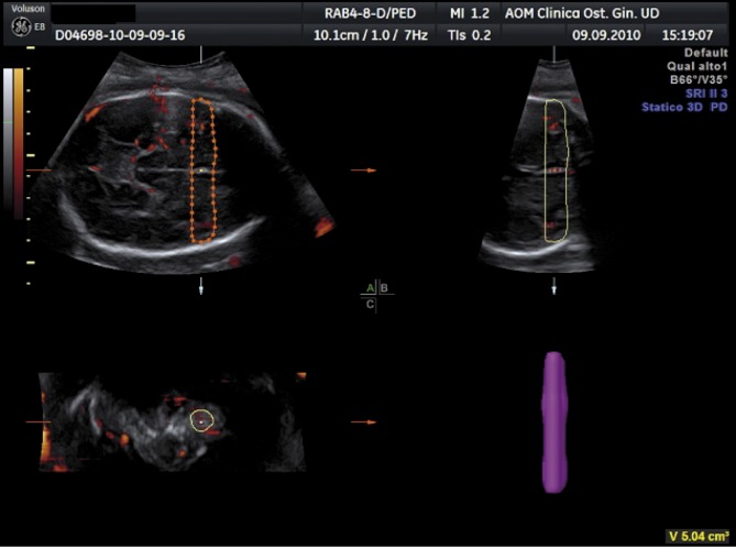 Fig. 3